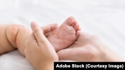 ILUSTRASI - Seorang ibu memperlihatkan kaki bayi mungil yang berbintik merah akibat terpapar virus campak.
