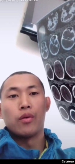 前中国“精神病监狱”受害者界立建2018年第三度遭精神病监禁后,出院后照的CT片。(照片提供:界立建)