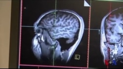 科学研究：男女大脑相似处多于预想