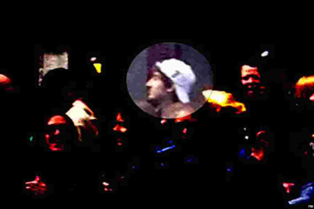 Nghi can 2 nhìn ngang, được khoanh tròn