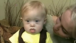 科学家正在研发检测唐氏综合症的手机应用 科学家正在研发检测唐氏综合症的手机应用