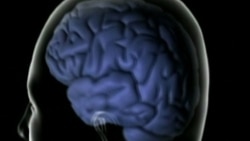 သက်ကြီးရွယ်အို စိတ်ကျန်းမာရေးနဲ့ မေ့လျော့ခြင်းရောဂါ သက်ကြီးရွယ်အို စိတ်ကျန်းမာရေးနဲ့ မေ့လျော့ခြင်းရောဂါ