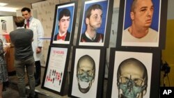 Bác sĩ Eduardo Rodriguez nói chuyện với các ký giả về cuộc phẫu thuật ghép mặt cho anh Richard Norris. Các ảnh bên phải là hình của anh Norris trước và sau cuộc phẫu thuật