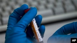 俄罗斯国家药品检测实验室的一名工作人员手持一个样本瓶。(资料照片)