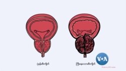 ဆီးကျိတ်ကင်ဆာအန္တရာယ် ဆီးကျိတ်ကင်ဆာအန္တရာယ်