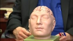 3D模型可帮助医生做好高难度手术 3D模型可帮助医生做好高难度手术