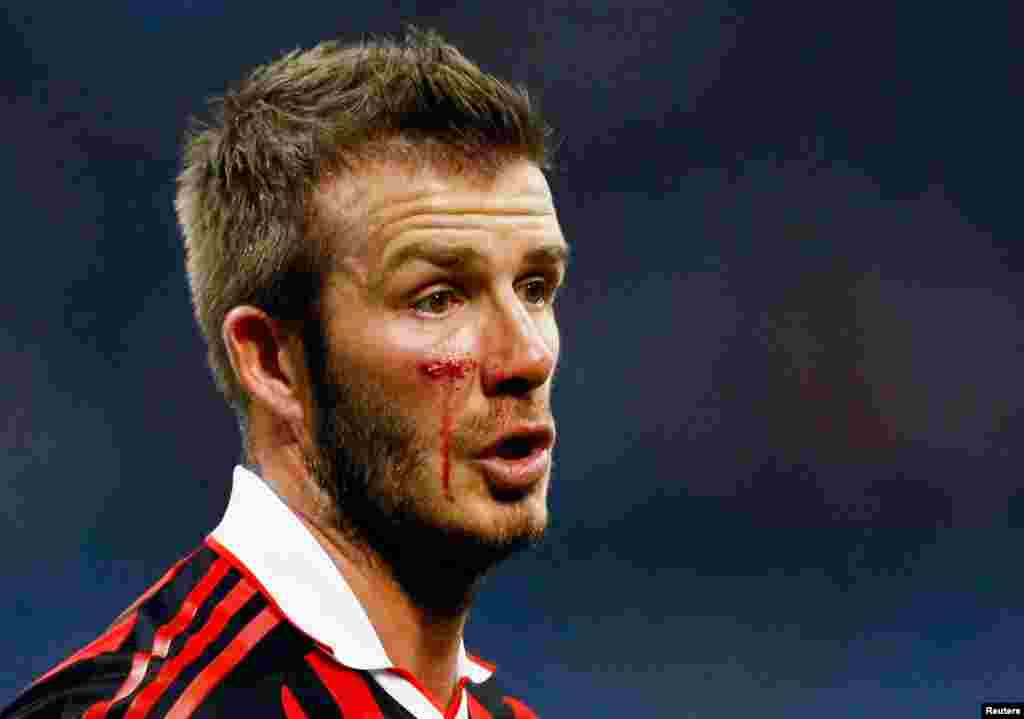 Beckham bị chấn thương sau một pha va chạm trong một trận đấu với đội Chievo thuộc giải Serie A của Ý, Milan, ngày 14 tháng 3, 2010.