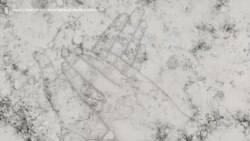 病毒是人类的敌人 也是艺术家的主题 病毒是人类的敌人 也是艺术家的主题