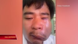 Human Rights Watch: Việt Nam phải ngưng tấn công các nhà hoạt động Human Rights Watch: Việt Nam phải ngưng tấn công các nhà hoạt động