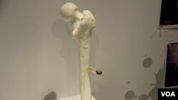 香港六四纪念馆展出从六四学生活动人士张健腿部取出的子弹 (美国之音记者申华拍摄)