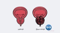 ကင်ဆာရှိမရှိ ကြိုတင်စစ်ဆေးမှု ကင်ဆာရှိမရှိ ကြိုတင်စစ်ဆေးမှု