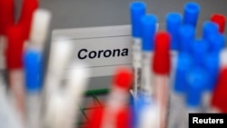 资料照:德国科隆一家医学实验室的冠状病毒检测试剂。(2020年3月24日)