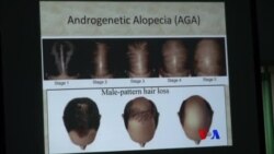 ဂရုစိုက်သင့်တဲ့ ဆံပင်ကျန်းမာရေး ဂရုစိုက်သင့်တဲ့ ဆံပင်ကျန်းမာရေး