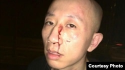 胡佳遇袭受伤(胡佳推特)