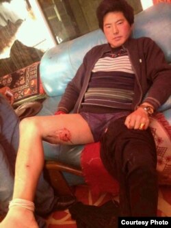 藏族青年丹正(Tamdin)在甘孜州炉霍县因进行宗教仪式遭到警察枪击,子弹击中右侧大腿。(图片由自由西藏运动提供)