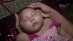 Một phụ nữ Hàn Quốc bị nhiễm virus Zika tại Việt Nam Một phụ nữ Hàn Quốc bị nhiễm virus Zika tại Việt Nam