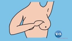 ရင်သားကင်ဆာ ခွဲစိတ်ပြီး လုပ်ရမယ့် လက်လေ့ကျင့်ခန်းများ “လူထုနဲ့ ကျန်းမာရေး” ရင်သားကင်ဆာ ခွဲစိတ်ပြီး လုပ်ရမယ့် လက်လေ့ကျင့်ခန်းများ “လူထုနဲ့ ကျန်းမာရေး”