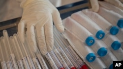 新型冠状病毒肺炎检测试剂。