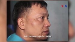 'Cải thiện nhân quyền phải là ưu tiên tại hội nghị Mỹ-ASEAN' 'Cải thiện nhân quyền phải là ưu tiên tại hội nghị Mỹ-ASEAN'