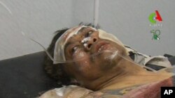 Một con tin sau khi được giải cứu đang được chữa trị tại bệnh viện ở Ain Amenas, Algeria, ngày 18/1/2013. 