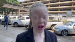 Muzvare Sithembile Kafeso AVO Vane Husope Vachitaura Pamusoro peMhando dzeMafuta Ekuzora Dzinoshanda Zvakanaka Kune Vane Husope vakawanda,