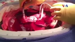 Cấy ghép gan có thể trở nên an toàn hơn nhiều Cấy ghép gan có thể trở nên an toàn hơn nhiều