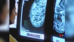 Giá trị của việc chụp quang tuyến vú Giá trị của việc chụp quang tuyến vú