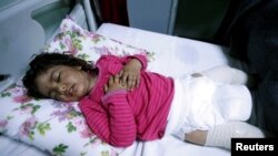 2017年3月4日,伊拉克摩苏尔西部的一家医院内,三岁的迪玛·纳德姆·哈米德正在接受疑似接触化武制剂治疗。